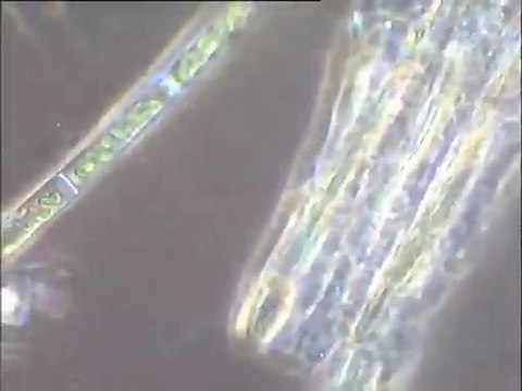 Détail des grosses fibres du prélèvement n° 2 : examen à très fort grossissement