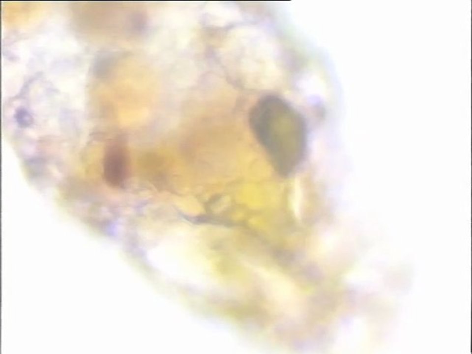 Détail d'une Difflugia (thécamibe) au microscope à fort grossissement