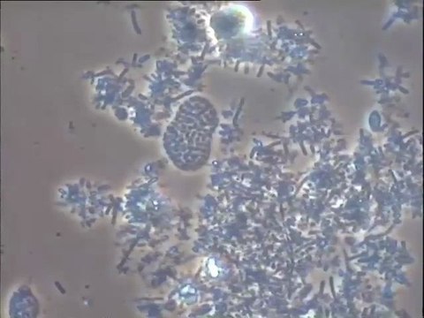 Examen des boues activées du système de membranes ultrafiltrantes Degrémont