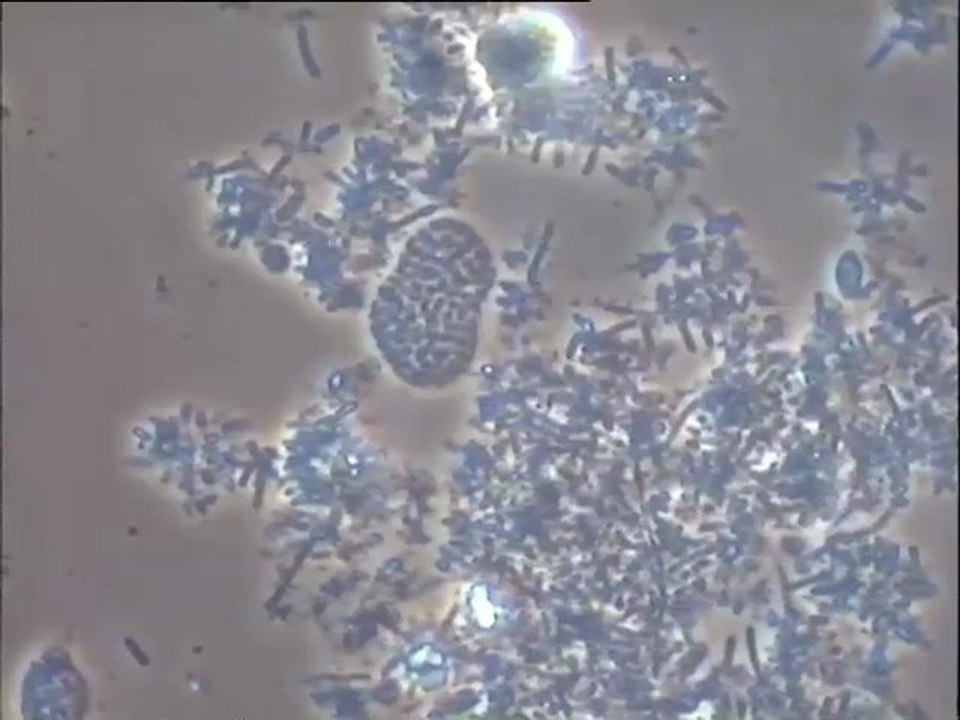 Examen des boues activées du système de membranes ultrafiltrantes Degrémont