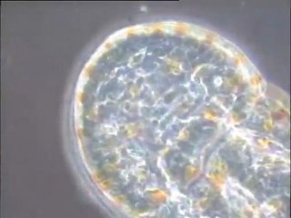 Détail des biomasses du sessile de Noisy-le-Grand : organismes rencontrés