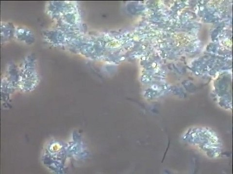 Examen des boues activées de la ville de Toulouse : station de Blagnac. Boues à forte charge (1er bassin)