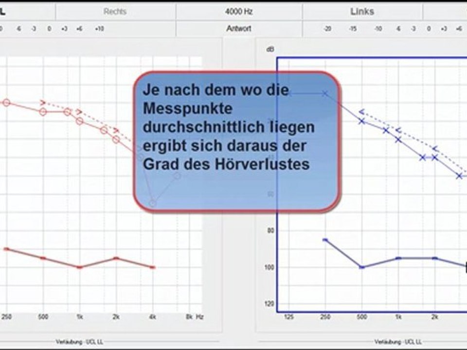 Hörtest teil 1 von 1a