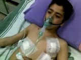 فري برس حلب  إعزاز  طفل مصاب جراء القصف 30 3 2012