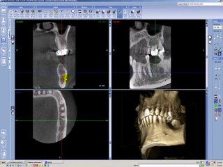 Evaluar la anatomía