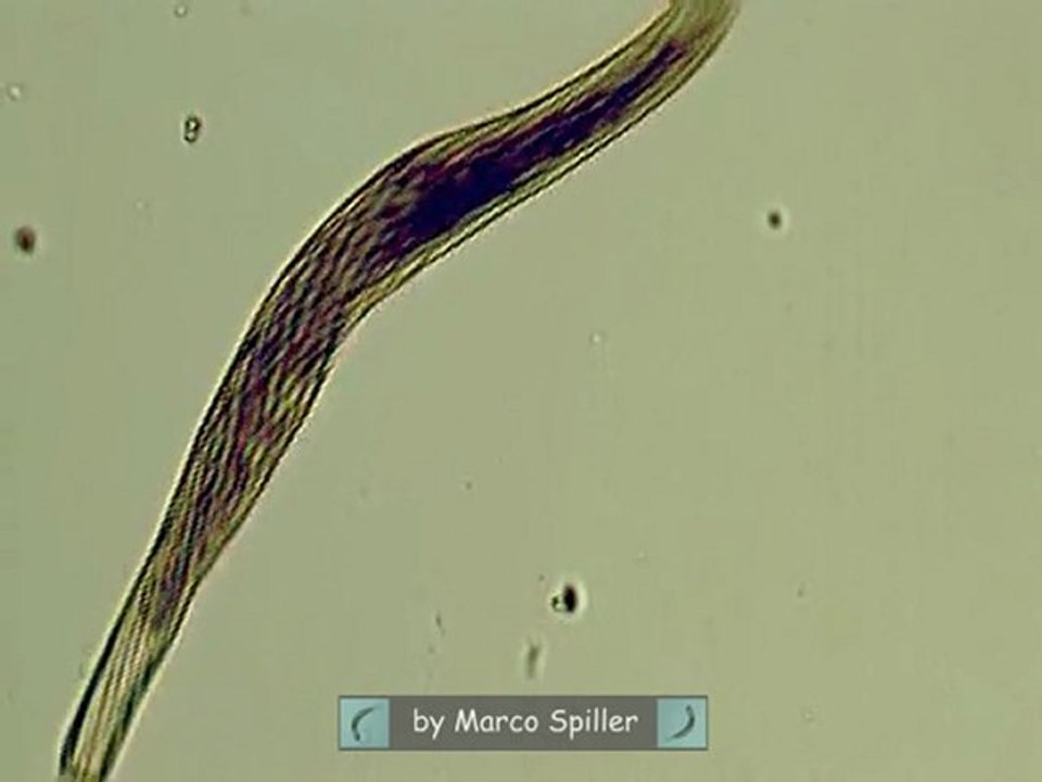 Spirostomum ambiguum