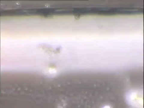 Etude d'une boue de lavage : examen des biomasses décrochées