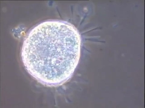 Etude de boues d'Achères III traitées à l'oxygène pur qui présentent des mousses marron