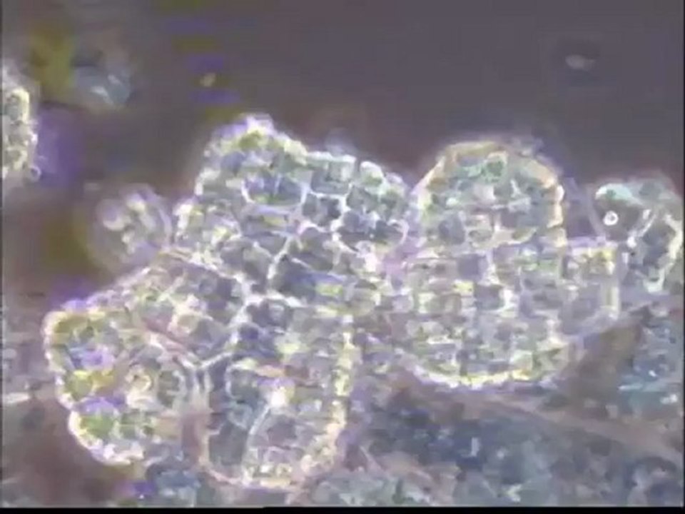 Examen des biomasses du deuxième réacteur SBR (sans filaments) et de la lagune de la sucrerie d'Eppeville (Picardie)