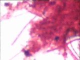Examen en coloration Gram de deux échantillons : bactéries décrochées des biolites du pilote de dénitrification au saccharose de Colombes, et bactéries filamenteuses du grand pilote de la sucrerie d'Eppeville (Picardie)