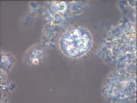 Examen des boues d’Irepolia : bassin de La Fremoire