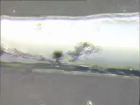 Essais d'élimination du filament 021N au chlorure ferrique à Noisy-le-Grand : examen de boues traitées depuis quelques jours (plus d'une semaine)