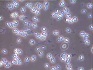 Etude comparative du jus de fermentation de choucroutes de diverses origines et de condiments