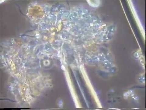 Examen des biomasses de boues activées de Malt Europe : expérience d'aération de deux flacons d'eau brute dont un mal aéré