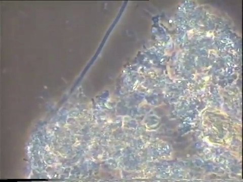 Essai d'ensemencement des boues activées de Malt Europe pour mettre en évidence un ensemencement en filament 1863 par les bassins tampons