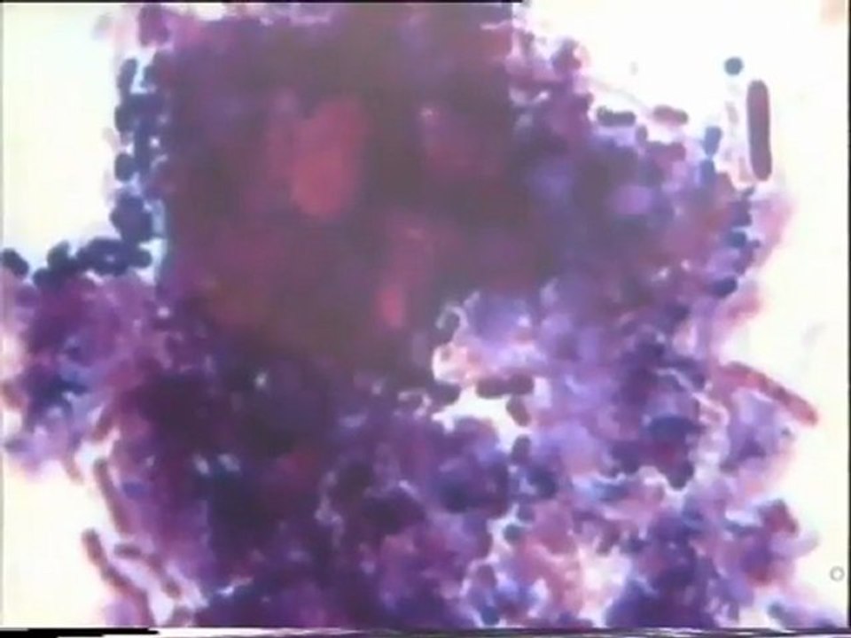 Coloration Gram d'une lame de l'échantillon témoin d'ensemencement des boues activées de Malt Europe par une boue activée au 1/1000e des bassins tampon