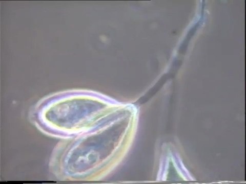 Examen au microscope des résultats d'ensemencement des eaux brutes de Malt Europe par la boue activée de leur bassin tampon, au 6e jour de l'expérience