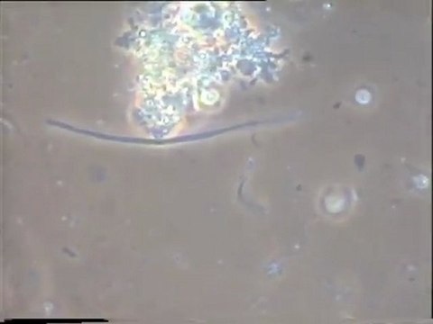 Expérience d'ensemencement des eaux brutes de Malt Europe par des boues de leurs bassins tampons : suite de l'essai n° 2 et fin