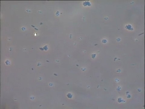 Examen de streptocoques au microscope