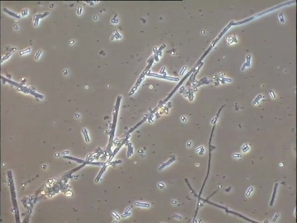 Examen d'une boue d'abattoirs (Brive) : détail des biomasses