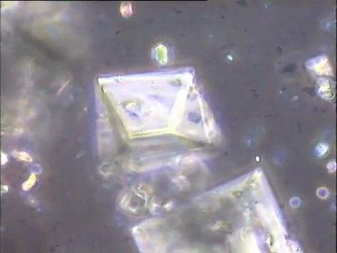 Expérience de formation de cristaux de struvite sur lisier de porc : observation de solutions à différentes concentrations (examen de la morphologie des cristaux et des bactéries)