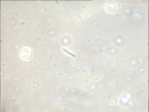 Examen au microscope à contraste de phase de l'effluent épuré de Porteous