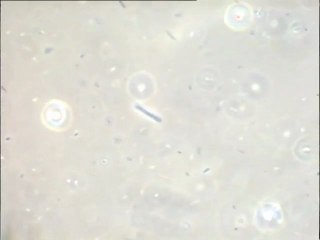 Examen au microscope à contraste de phase de l'effluent épuré de Porteous