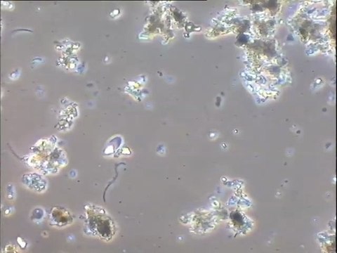Expériences de cristallisation de struvite sur l'effluent de Porteous, en faisant varier les concentrations de réactifs (oxyde de magnésium variable, acide phosphorique fixe)
