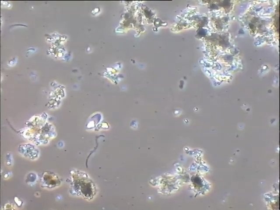 Expériences de cristallisation de struvite sur l'effluent de Porteous,  en faisant varier les concentrations de réactifs (oxyde de magnésium variable, acide phosphorique fixe)
