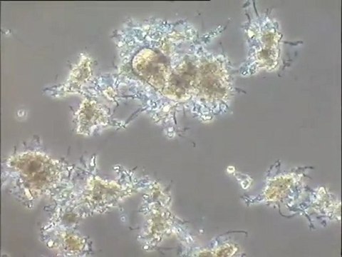 Examen des boues mousseuses du Carré de Réunion : détail des biomasses et des filaments (Nocardia)