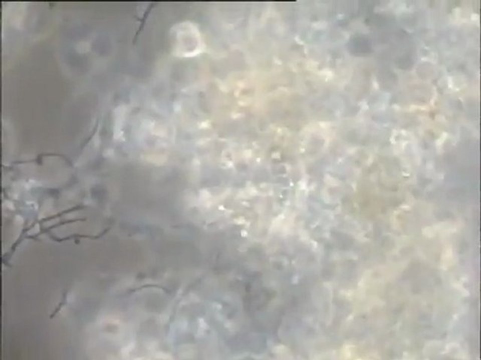 Examen d'une boue activée mousseuse du Carré de Réunion : détail des biomasses au microscope fort grossissement