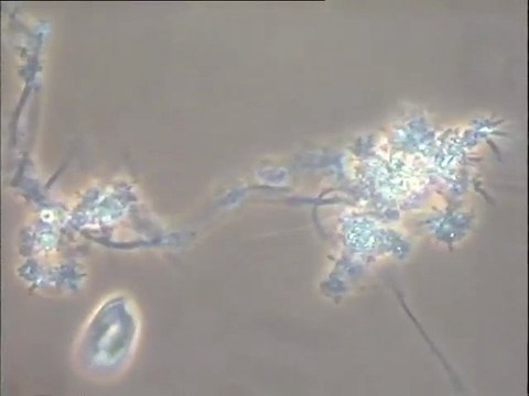 Examen des boues de la fromagerie Bel Sablé après traitement anti-mousse : évaluation du résultat, comparaison de deux filières dont une avec du chlore