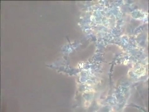 Détail des biomasses d'une boue activée filamenteuse au microscope à fort grossissement