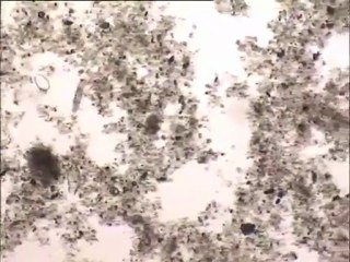 Comptage de faune dans une boue traitée par anti-mousse