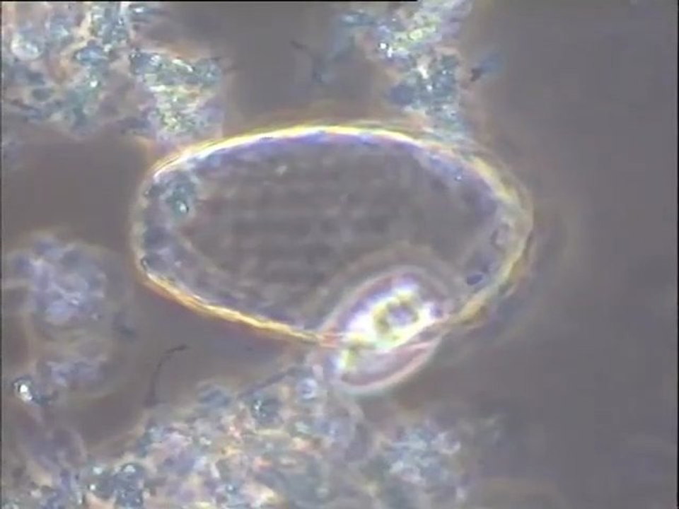 Examen des boues de l'effluent de l'usine Bordeau-Chesnel (fabrique de rillettes) : détermination des faunes majoritaires après un traitement anti-mousse