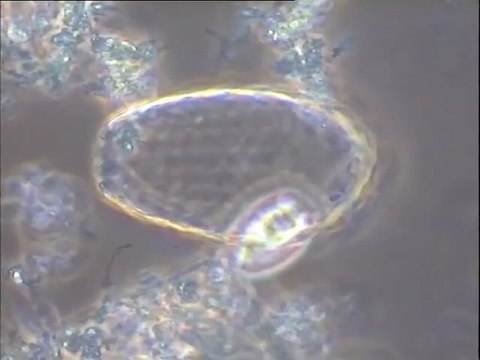 Examen des boues de l'effluent de l'usine Bordeau-Chesnel (fabrique de rillettes) : détermination des faunes majoritaires après un traitement anti-mousse