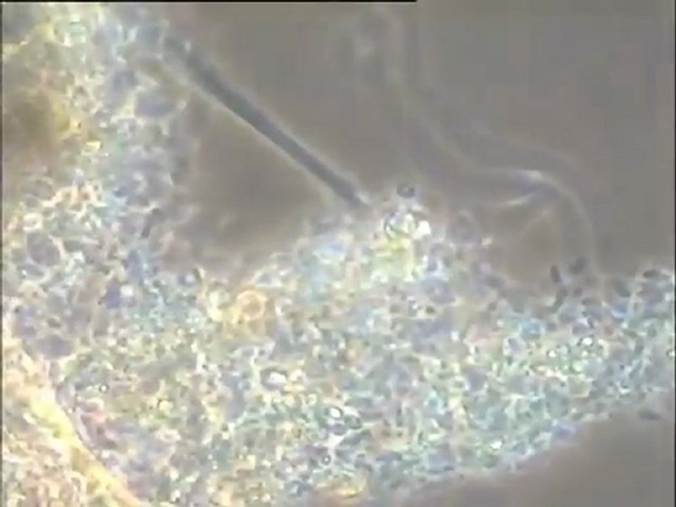 Examen des boues du bassin d'Achères III : observation de la microfaune au microscope à fort grossissement