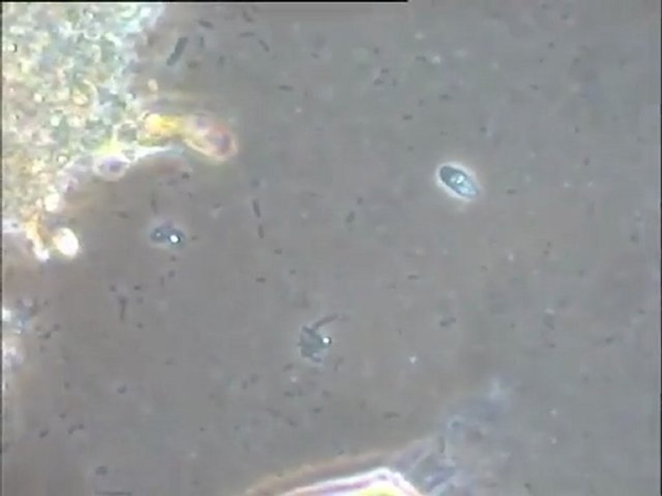 Expérience de formation d’une boue activée in vitro – troisième étape (4e jour) : examen d'un échantillon de boue avant décantation