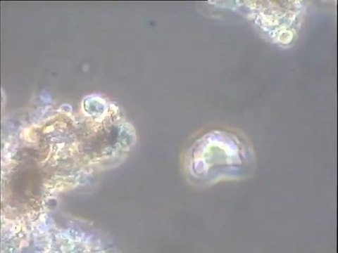 Expérience de formation d’une boue activée in vitro – quatrième étape (5e jour) : observation d’une boue mélangée