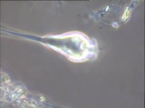 Examen à fort grossissement des bio-faunes d'un échantillon de boue activée (station de Versailles)