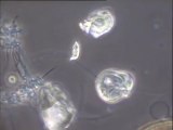 Détail de microorganismes des boues activées : amibes et protozoaires