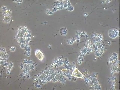Examen des biomasses des flottants et du surnageant du clarificateur de la station du Carré de Réunion
