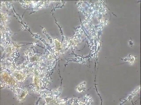 Examen de boues filamenteuses de la station de Versailles et d'un échantillon de mousse