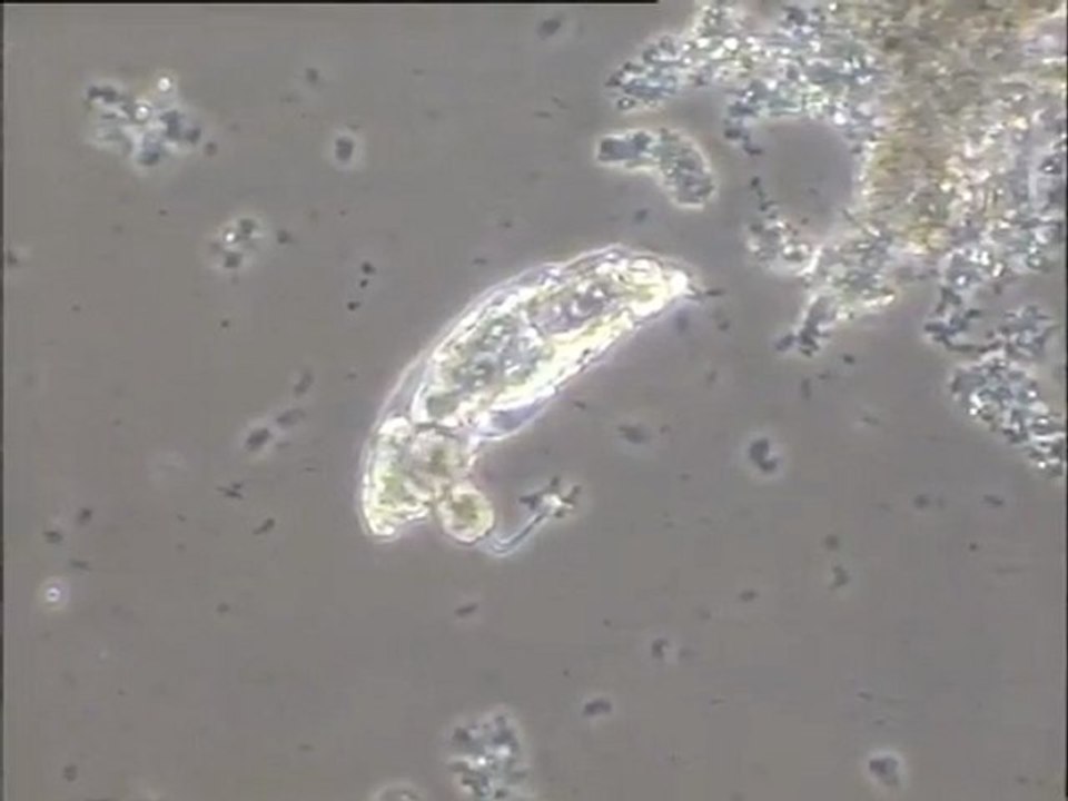 Observation d'une population de rotifères sur un boue mise en aération avec du talc : prédation d'un rotifère sur un zoïde de péritriche