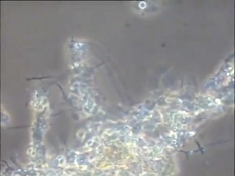 Examen d'une boue activée de la station de Bayonne