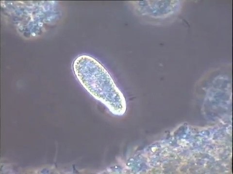 Observation de plusieurs préparations de boues activées de la station de Noisy-le-Grand : boue traitée au talc et témoin, boues maintenues en aération