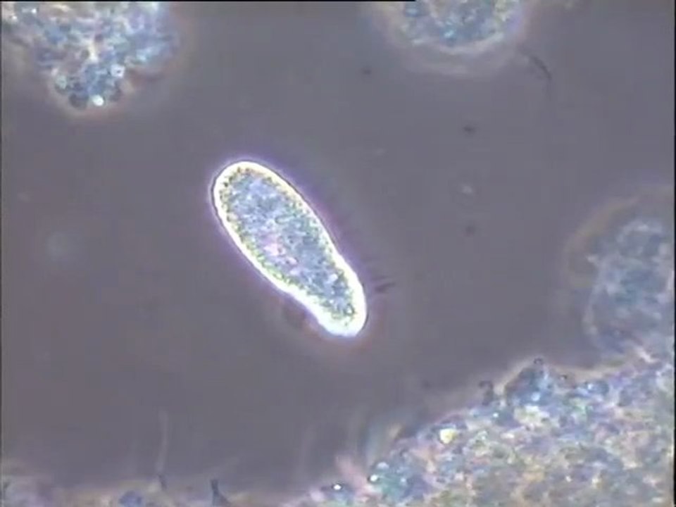 Observation de plusieurs préparations de boues activées de la station de Noisy-le-Grand : boue traitée au talc et témoin, boues maintenues en aération
