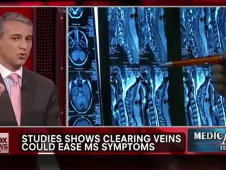 New Multiple Sclerosis Treatment