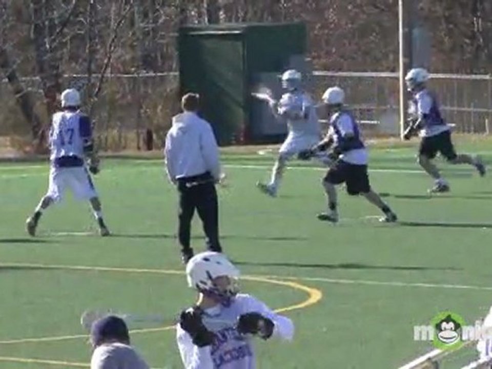 Concussion Causes