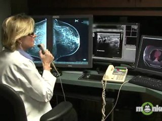 Understanding Breast Cancer - Staging